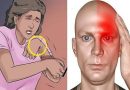 10 riasztó tünet, ami a közeledő stroke jele