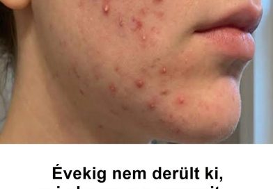 Évekig nem derült ki, mi okozza a panaszait – ezek voltak a PMOS figyelmeztető jelei