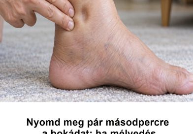 Nyomd meg pár másodpercre a bokádat: ha mélyedés marad utána, ezt érdemes tudnod